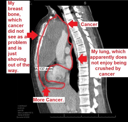 My lungs were kind of against this whole thing.