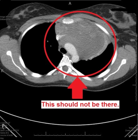 Stop looking at my boobs, Internet